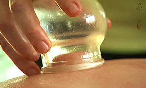 cupping services